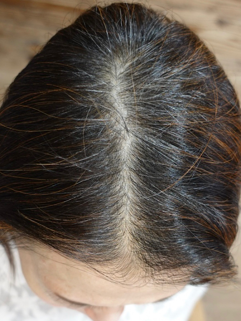 ヘナする前の白髪